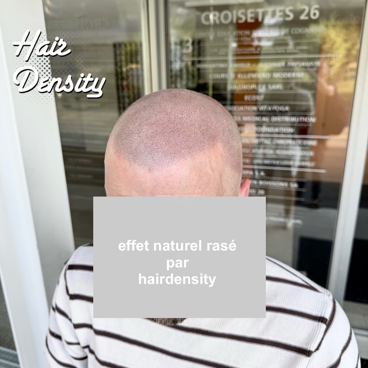 trichopigmentation hairdensity.ch