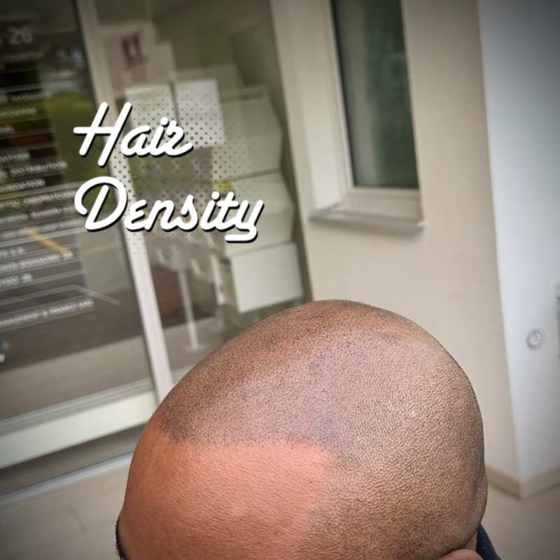tricopigmentation effet rasé hairdensity.ch