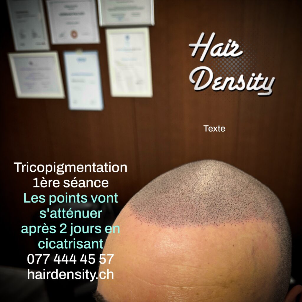 tricopigmentation effet rasé hairdensity.ch